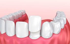 Restorative Dentistry